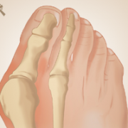 voet-hallux-valgus-anatomie