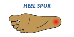 heelspur work shoes for heel spur